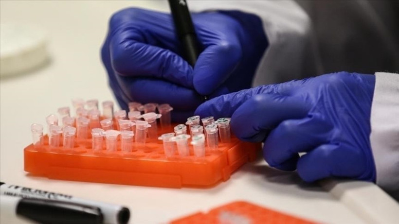 İngiltere Uyardı: Türkiye'de Maymun Çiçeği mi Tespit Edildi?