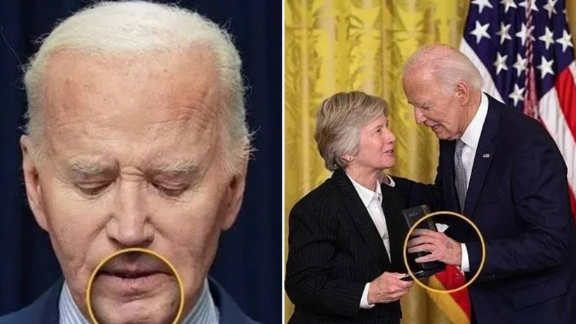 Eski ABD Başkanına Bir Kanser Teşhisi Daha! Gizlice Ameliyata Alındı