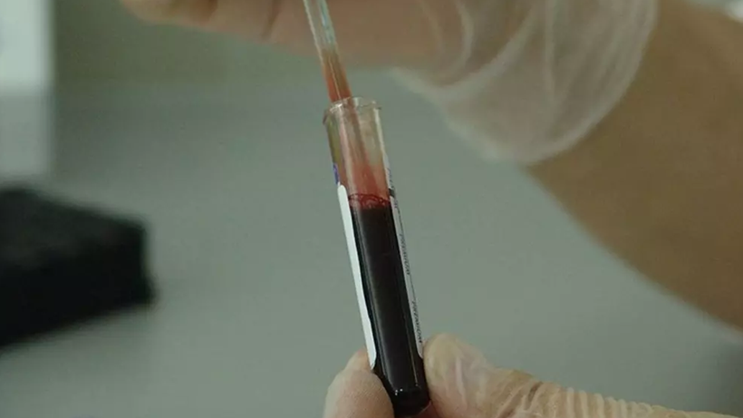 Her 2,8 Saniyede Bir Kişi Ölüyor! Sessiz Katilin Gizli Altın Saati Ortaya Çıktı