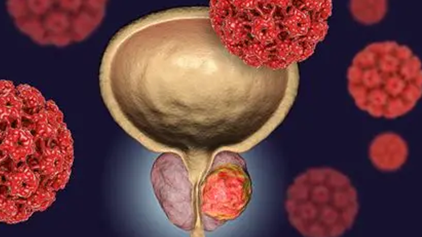 50 Yaş Üstü Erkeklere Hayati Uyarı: ‘Sakın İhmal Etmeyin’