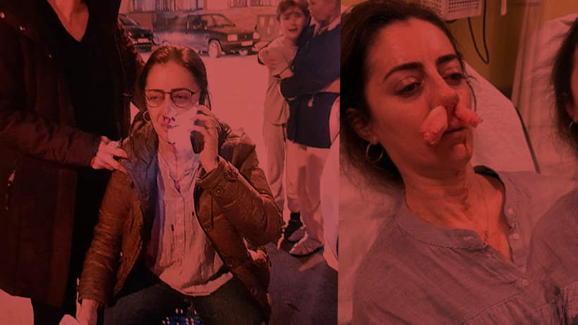 Eşinin Sevgilisi Sandığı Kadını Öldüresiye Dövmüştü! İstenen Ceza Belli Oldu