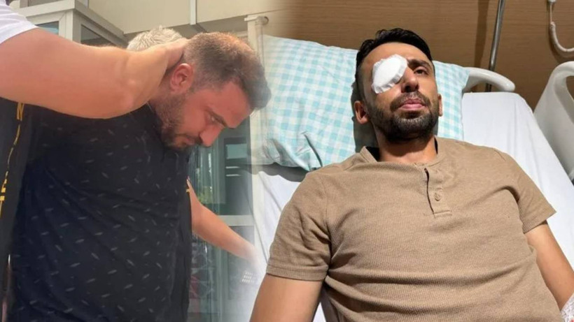Bekçilere Ateş Açtı, Belediye İşçisi Gözünü Kaybetti: 'Hiçbir Suçum Yokken Beni Yarım İnsan Haline Getirdi'