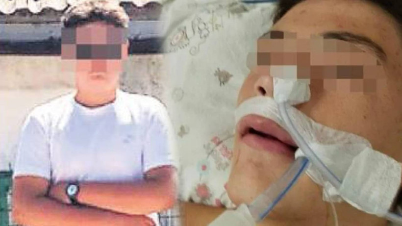 Çanakkale'de Akran Zorbalığı: Ayağına Bastı Diye Sınıf Arkadaşını Öldüresiye Darbetti