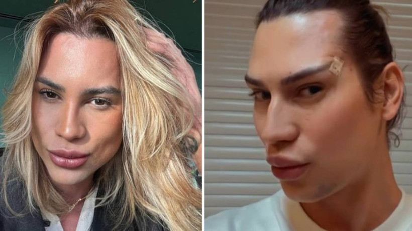 Estetik Ameliyatı Hayatına Mal Oldu! Brezilyalı Fenomenin Acı Ölümü