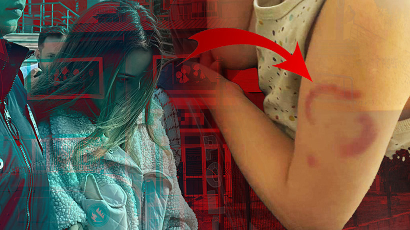 Kan Donduran Olay! Daha 3 Yaşında... Baba, Dehşeti Çocuğu Ağlayınca Fark Etti: 'Bir Daha Kreşe Göndermeyeceğim!'