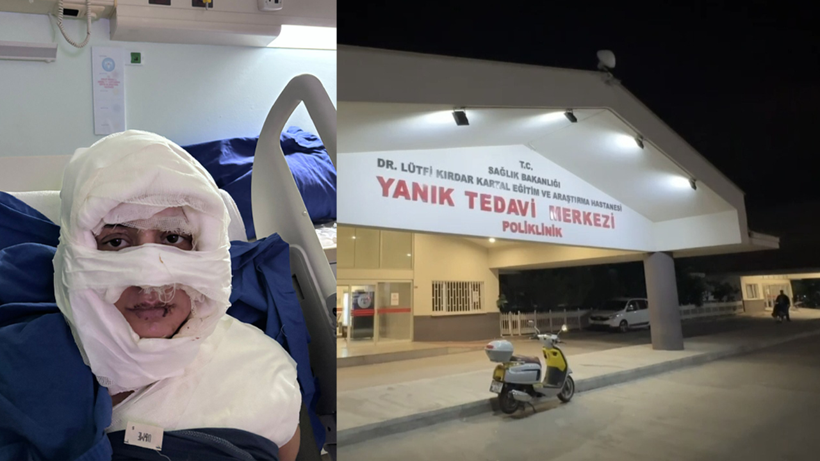 Kadıköy'de Vahşet! Genç Kadını Benzin Dökerek Yaktı