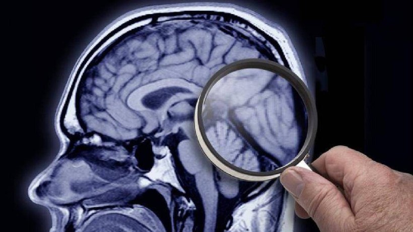 Alzheimer'ın Yeni Belirtisi Ortaya Çıktı, 193 Dakikadan Uzunsa Risk Çok Büyük - Resim : 1