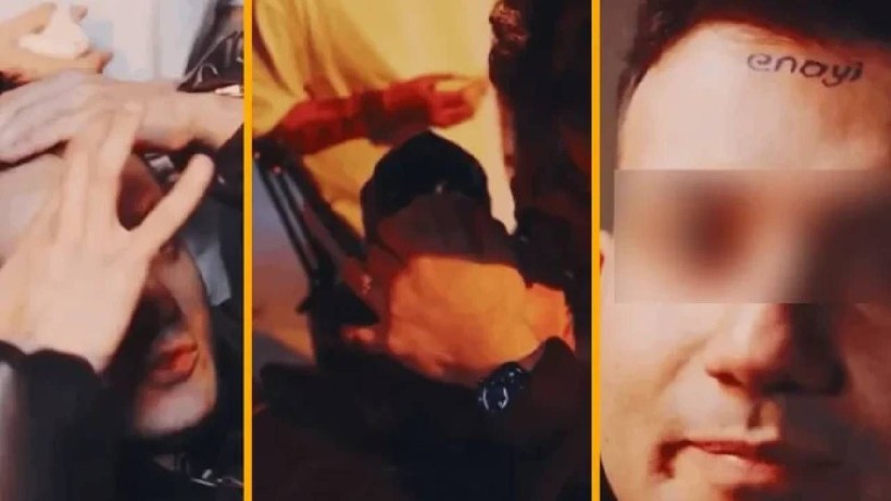 80 Bin TL İçin Alnına Yaptırdığı Dövmeyi Görenler İnanamadı: Orkun Işıtmak’ın Açık Eksiltme Programında Skandal - Resim: 3
