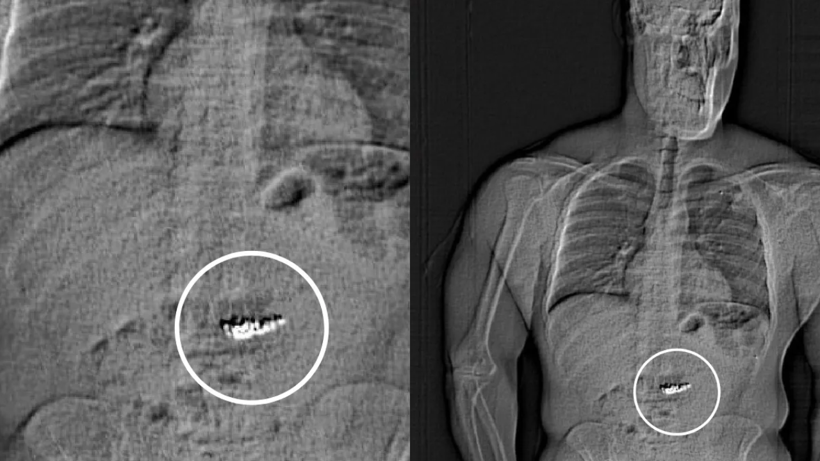 Polisi de Hırsızı da Alarma Geçirdi: Midesinde 28 Milyon 200 Bin Liralık Servet Taşıyor! - Resim: 1