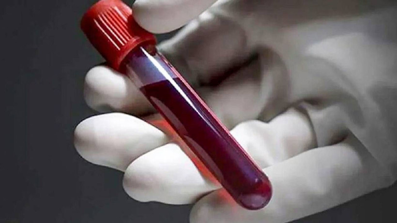 Keneler İçin En Çekici Kan Grubu Belli Oldu: Bu Kan Grubundakileri Daha Çok Isırıyorlar - Resim: 2