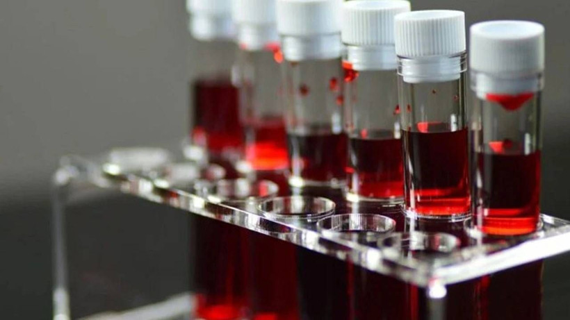 Keneler İçin En Çekici Kan Grubu Belli Oldu: Bu Kan Grubundakileri Daha Çok Isırıyorlar - Resim: 1