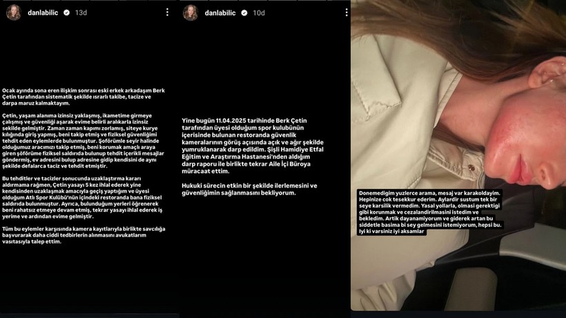Danla Bilic Görür Görmez Ateş Püskürdü, Yumruklu Saldırı Sonrası Çirkin Yorumlar - Resim : 4
