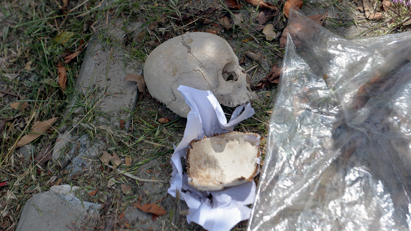 Çöpte Bulunan Kafatasının Gizemi Çözüldü! Kimsenin Aklına Gelmeyen Gerçek Ortaya Çıktı - Resim : 1