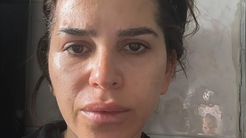 Hayat Karartan Tavsiye! Güzellik İçin Masaya Yattı, Kabusa Uyandı - Resim : 2