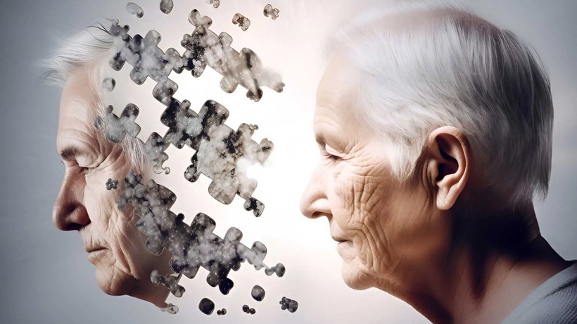 Alzheimer Ağızdan mı Başlıyor? Bilim İnsanlarından Dikkat Çeken Bulgular - Resim : 1