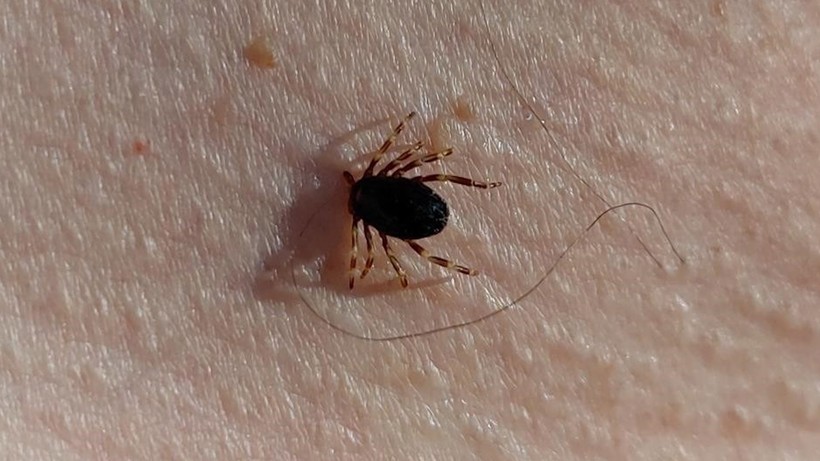 Kışın Gizlenen Yazın Dirilen Kabus Büyüyor! Bir Can Daha Aldı… Ölü Sayısı 7’ye Ulaşan İlde Alarm - Resim : 3