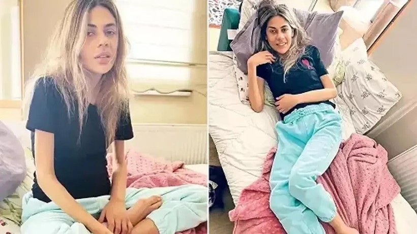 Nihal Candan’ı Ölüme Sürükleyen Hastalık! Anoreksiya Nervoza Nedir? Herkes İştahsızlık Sanıyor Ama Tehlike Daha Büyük - Resim : 4