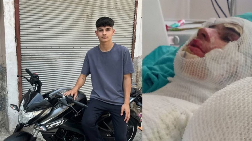 Adana’da Korkunç ‘Amca’ Dehşeti! 16 Yaşındaki Yeğenini Yaktı, O da Yetmedi Suçu Ağabeyinin Üstüne Attı - Resim : 1
