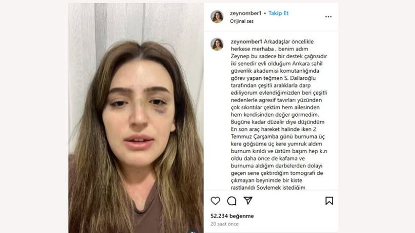 Jandarma Eşinden Korkunç İddialar! ‘Sesim Olun’ Çağrısına Gülben Ergen Sessiz Kalmadı - Resim : 1