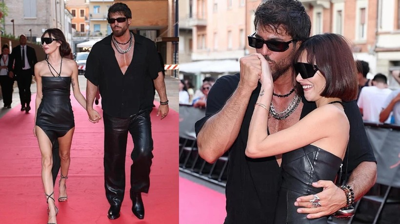 Can Yaman’ın Sevgilisinden Korkunç İtiraf! Kanlar İçinde Fotoğraflarını Paylaştı, Ortalık Karıştı - Resim : 3