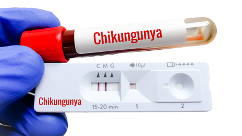 75 Yıl Önceki Ölümcül Kabus Avrupa’da Dirildi! DSÖ Uyardı, Dünya Yeni Salgının Eşiğinde - Resim : 2