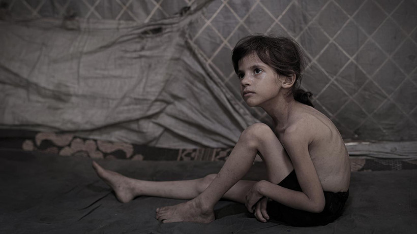 Bu Fotoğraflara Bakmaya Yürek Dayanmaz: Gazze'de Açlık Can Almaya Devam Ediyor! Minik Bedenler Göz Göre Ölüyor - Resim: 2