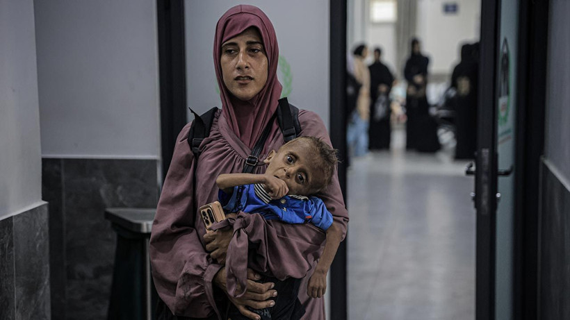 Bu Fotoğraflara Bakmaya Yürek Dayanmaz: Gazze'de Açlık Can Almaya Devam Ediyor! Minik Bedenler Göz Göre Ölüyor - Resim: 1