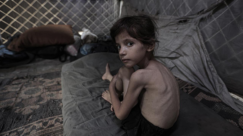 Bu Fotoğraflara Bakmaya Yürek Dayanmaz: Gazze'de Açlık Can Almaya Devam Ediyor! Minik Bedenler Göz Göre Ölüyor - Resim: 5