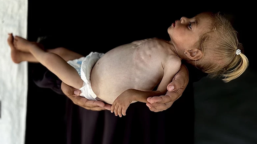 İsrail’in Ölüm Çemberiyle Sardığı Gazze’de Kefen Kalmadı! ‘Giden Sağ Dönmüyor’ - Resim : 3