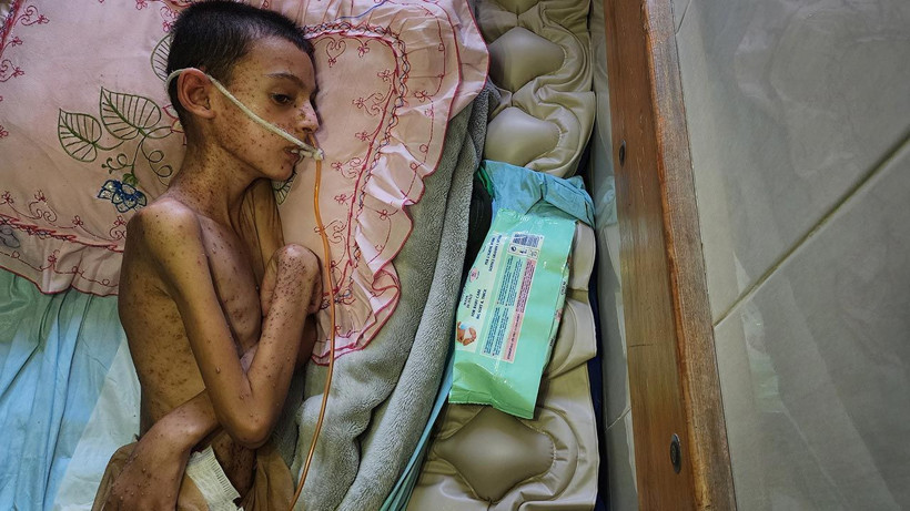 Bu Fotoğraflara Bakmaya Yürek Dayanmaz: Gazze'de Açlık Can Almaya Devam Ediyor! Minik Bedenler Göz Göre Ölüyor - Resim: 6