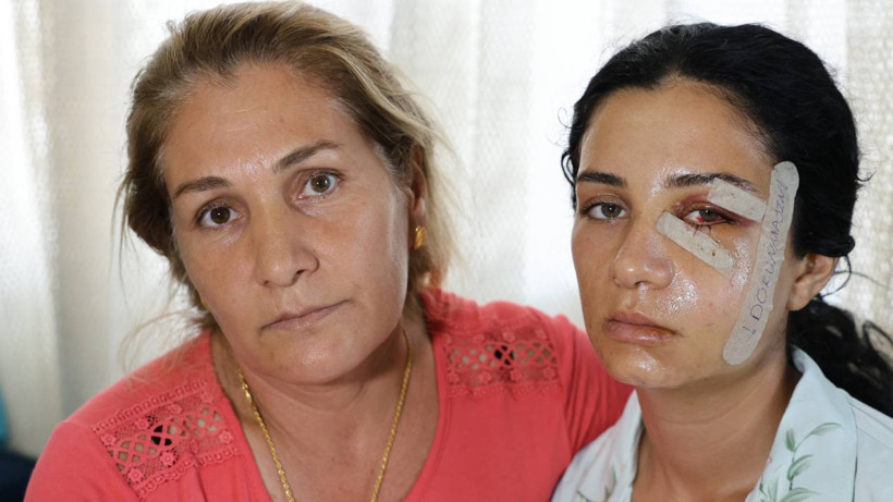 Sedef'in Yaşam Çığlığı: Ölümden Mesaj Atarak Kurtuldu! 'Yaşarken Kurtulayım, Öldükten Sonra Değil' - Resim : 1