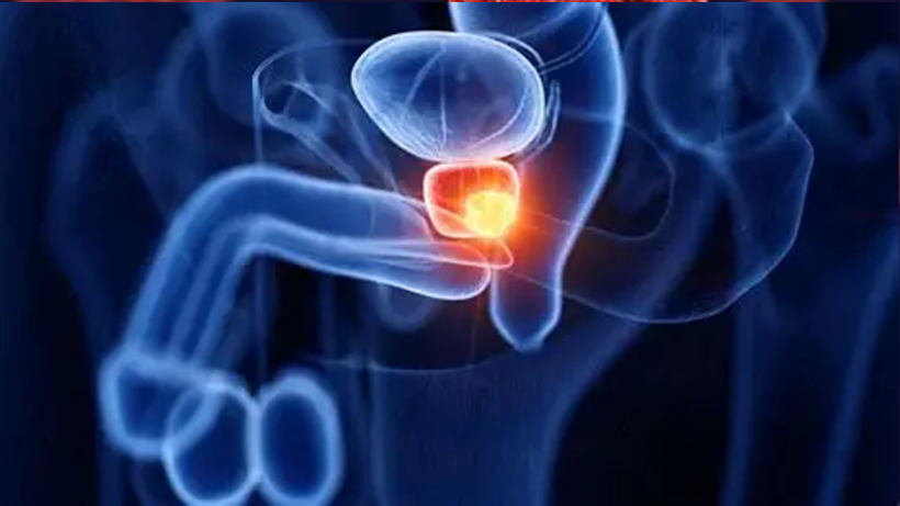 50 Yaş Üstü Erkeklere Hayati Uyarı: ‘Sakın İhmal Etmeyin’ - Resim : 1