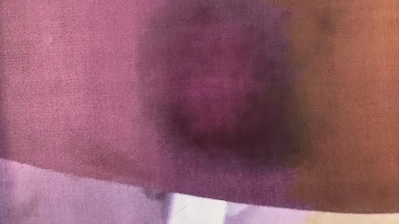 Her Detayı Kan Donduran Dava! Cinsel Saldırı, Tehdit, Yaralama… Hem Eşine Hem Kızına Dehşeti Yaşattı - Resim : 2