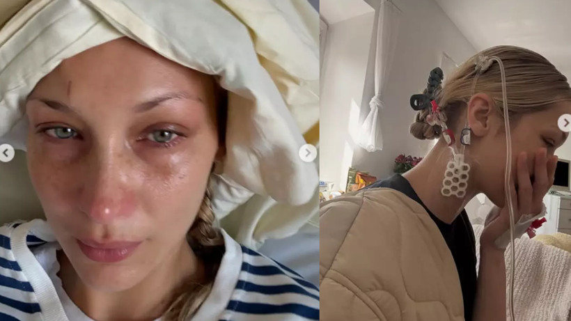 Podyumların Yıldızı Ünlü Model Bella Hadid Yeniden Hastanelik Oldu! 15 Yıllık Acı, 100’den Fazla Tedavi - Resim : 3
