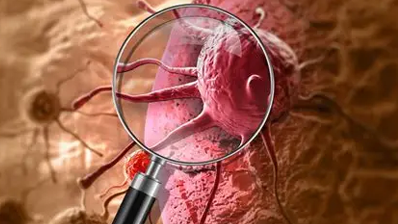 2050’de Dünyayı Bekleyen Tehlike! Vakalar 30 Milyonu Ölü Sayısı 18 Milyonu Aşabilir - Resim : 1