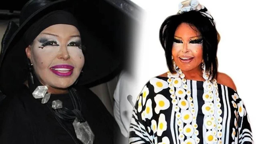 Servetiyle Ne Yapacağını Şaşıran Bülent Ersoy'dan Bomba Açıklama! Bakın 'Miras' Kriteri Neymiş... - Resim: 2