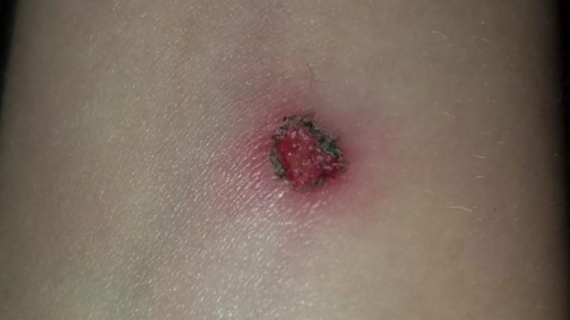 Geceleri Belirtisi Artan Hastalık İçin Aydın'da Alarm! Kış Geldi Vakalar Pik Yaptı - Resim : 3