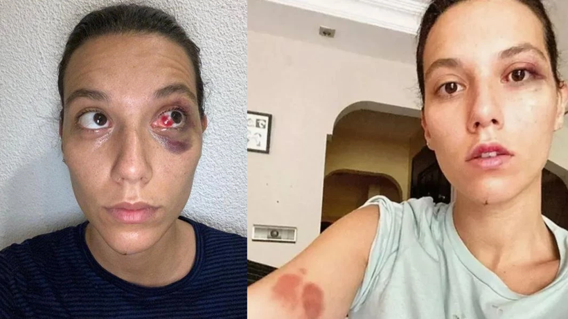 Kadına Şiddetten Ceza Alan Ozan Güven'den Şaşırtan Savunma! 'Sabun Kaçmış Olabilir' - Resim : 1