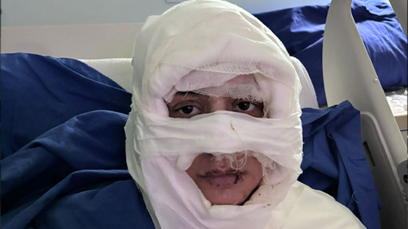 Kadıköy'de Vahşet! Genç Kadını Benzin Dökerek Yaktı - Resim : 1