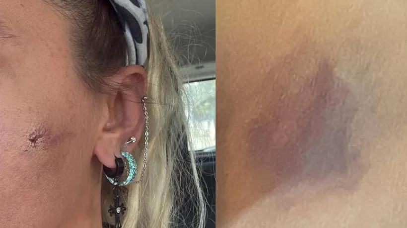 Ünlü Oyuncu Yıldız Asyalı'dan Şoke Eden Açıklama: ‘Kocam Tarafından Darbedildim’ - Resim : 3