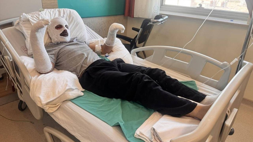 Kars'ta Mutfakta Dehşet: &Ccedil;ay Demlemek İsterken Canından Oluyordu - Resim : 1