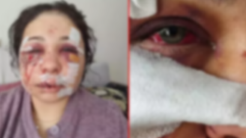 Eşini Ağır Şekilde Darp Eden Polis Tutuklandı! Bakanlardan Peş Peşe Açıklamalar - Resim : 1