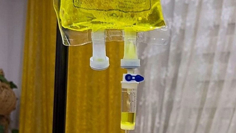 'Sarı Serum'da Ölüm Riski: Uzmanlar Uyardı, İyileşmek İsterken Canınızdan Olmayın - Resim : 1
