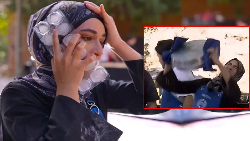 Yüzüne Kızgın Yağ Dökülmüştü... Masterchef Beyza Yüzünün Yanık Halini İlk Kez Paylaştı - Resim : 2