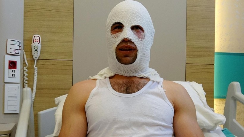 Nişanlısına Hediye Hazırlarken Dehşeti Yaşadı: Sprey Boya Bomba Gibi Patladı - Resim : 1