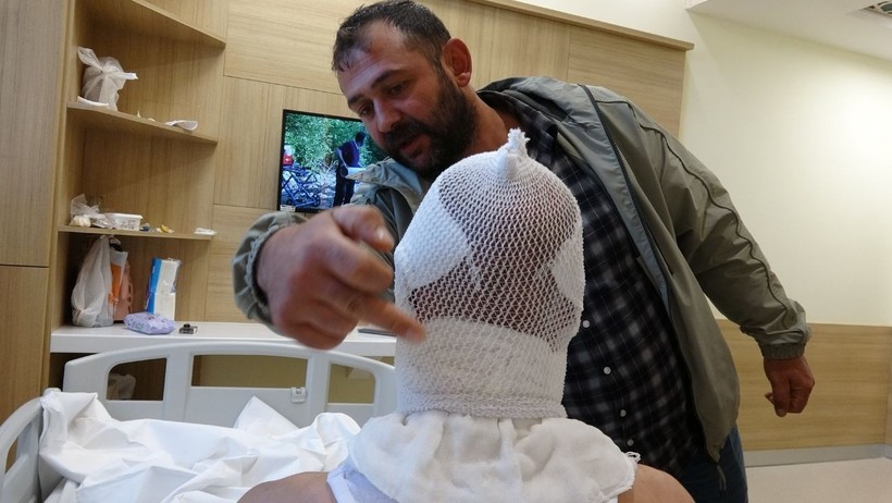 Nişanlısına Hediye Hazırlarken Dehşeti Yaşadı: Sprey Boya Bomba Gibi Patladı - Resim : 2