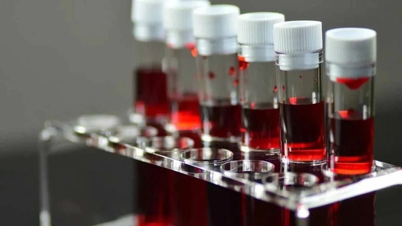 Bu Kan Grubuna Sahip Kişiler Erken Yaşta Alzheimera Yakalanıyor! Risk Almamak İçin Bunları Yapın - Resim : 2