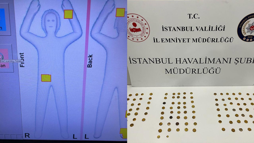 İstanbul Havalimanı’nda Sıra Dışı Olay! 3 Kadının Genital Bölgesinden 6 Kilo Altın Çıktı - Resim : 3
