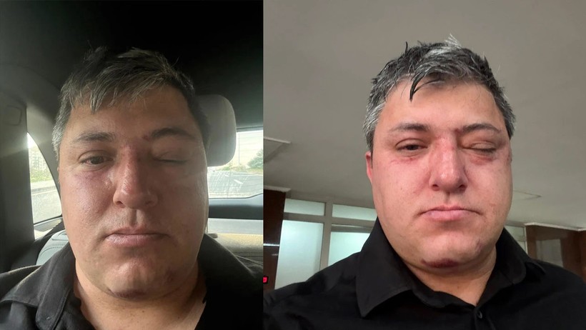 'AKP'li Başkan Veysel Tiryaki'den Memura Darp' İddiası! Dehşete Düşüren Anları Anlattı - Resim : 1