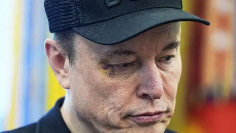 Morluklar Dikkat Çekti... Elon Musk’ın Yüzüne Ne Oldu? İlk Kez Açıkladı - Resim : 1